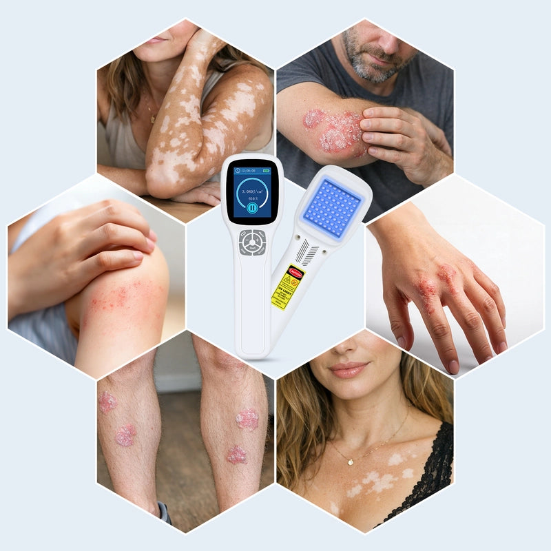 ZJKC Handheld Excimer UVB Light Therapy 308nm Home Phototherapy Device Relief for Vitiligo, Psoriasis & Dermatitis